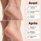 Sofelya — Râpe électrique anti-callosités